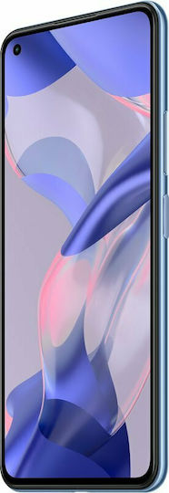 Xiaomi 11 Lite 5G NE Dual SIM (6GB/128GB) Bubblegum Blue view 5