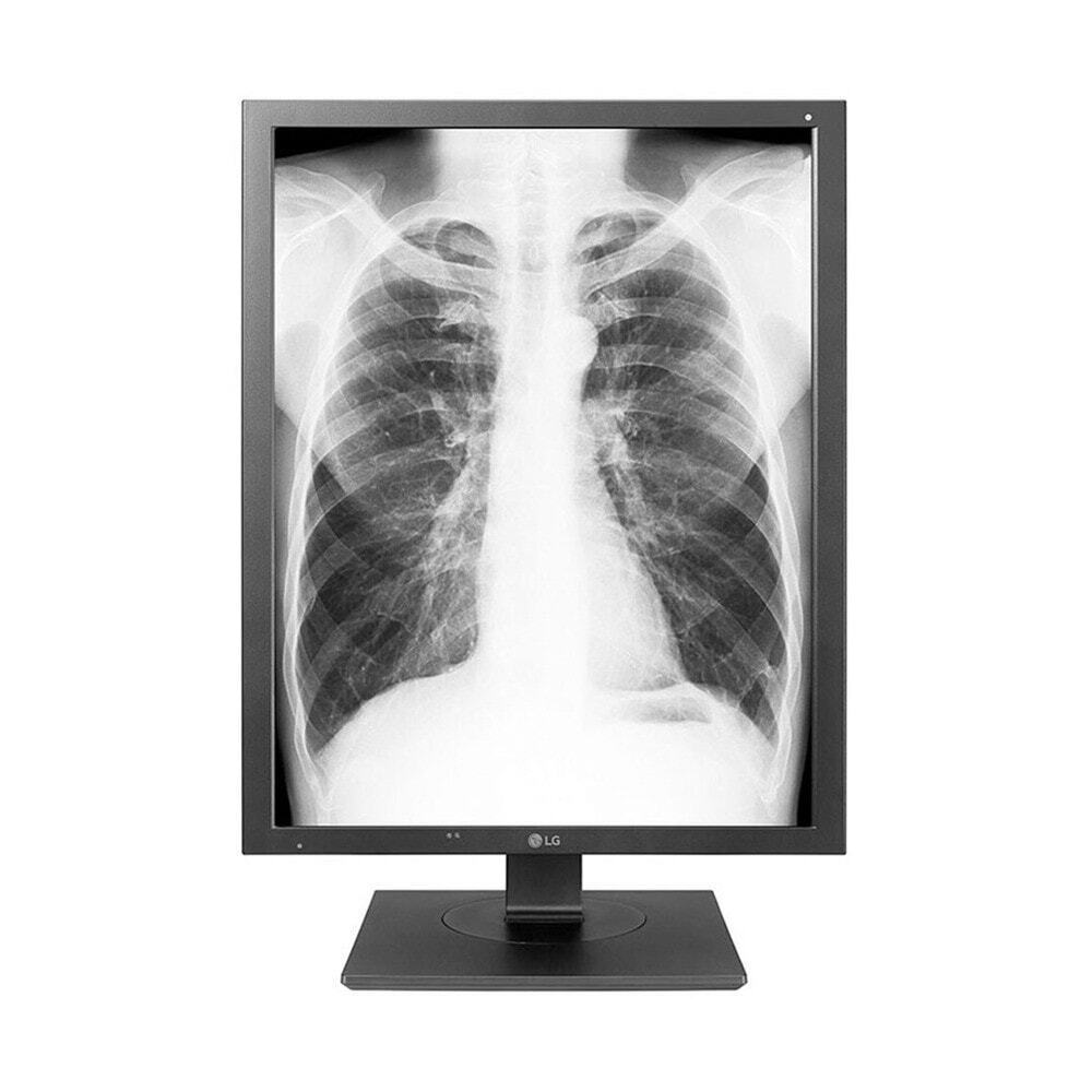 LG 21HK512D-B IPS HDR Monitor 21.3" 2048x1536 with Response Time 30ms GTG view 1