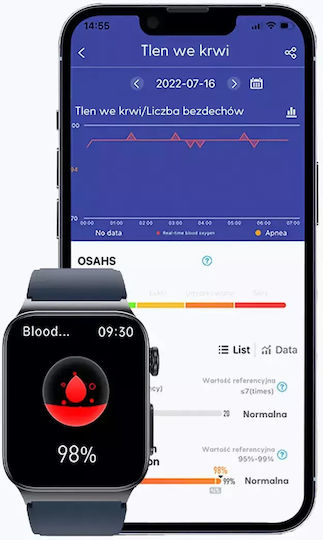 Watchmark Cardio One Smartwatch with Heart Rate Monitor (Blue) view 8